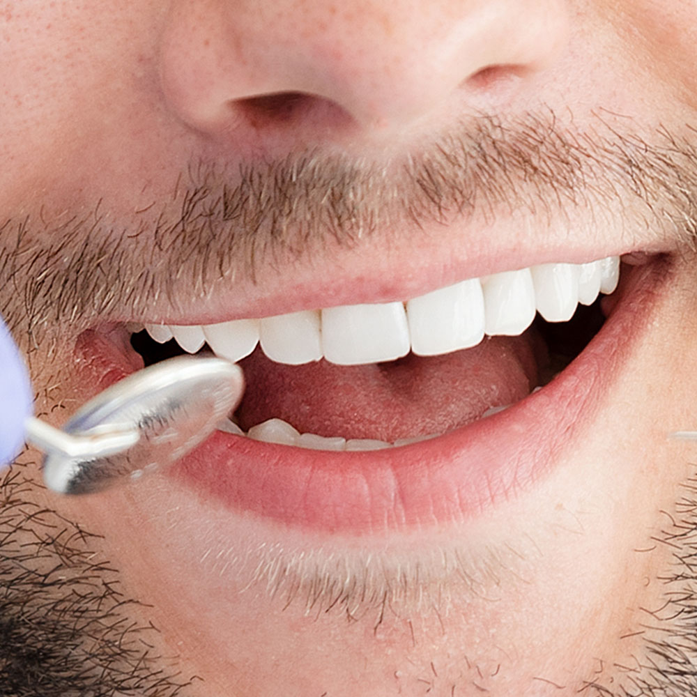 Dental patient smiling near Pico Rivera