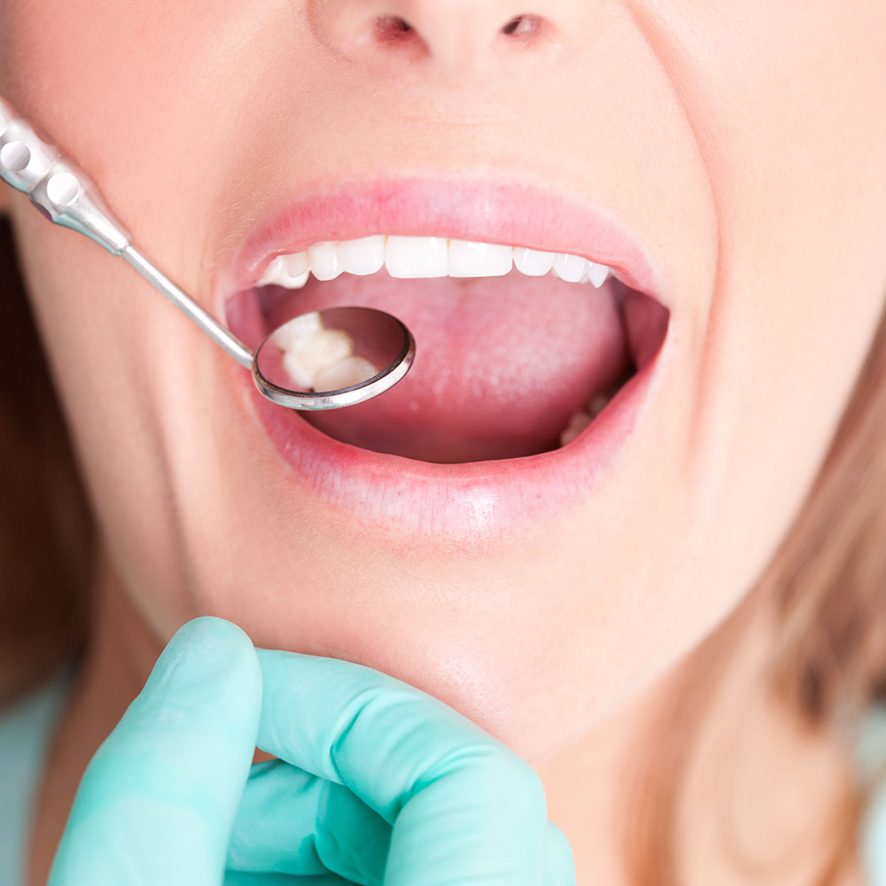 Emergency dental exam near South Gate